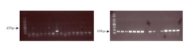 그림 23. PCR results targeted to aggR(EAEC) and ST(ETEC) gene