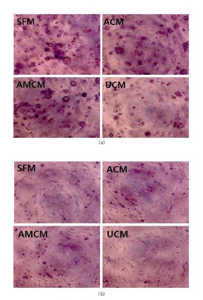 그림 27. MSCs-CM에서 배양 후 형성된 암세포의 콜로니 결과