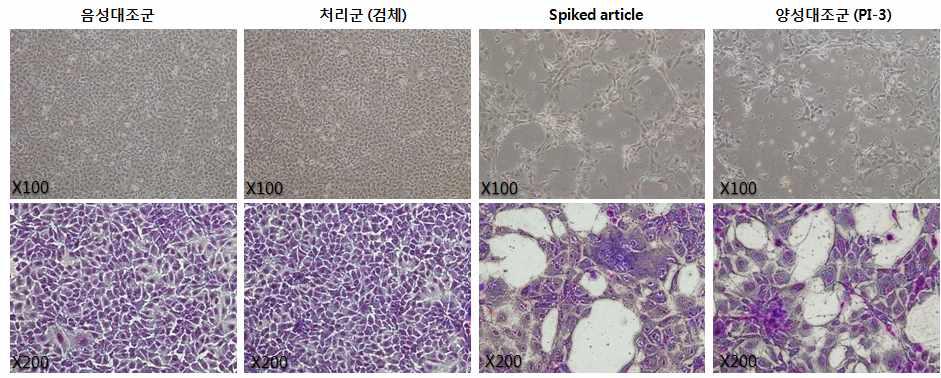 배양 20일째 세포 형태 관찰 (Top, 100배)과 김자염색 결과 (Bottom, 200배)