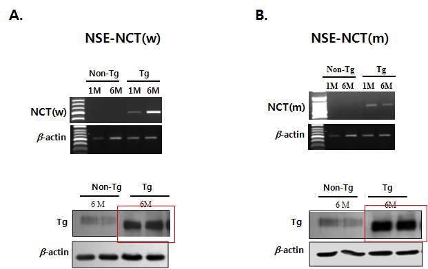 Figure 1. Brain-specific expressions of the transgenes by RT-PCR and western blot analysis