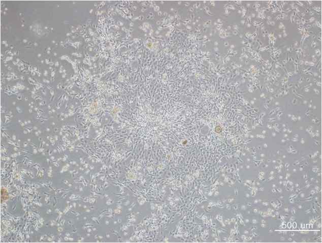 Fig. 14. 분리 후 2일된 mouse fibroblast 세포