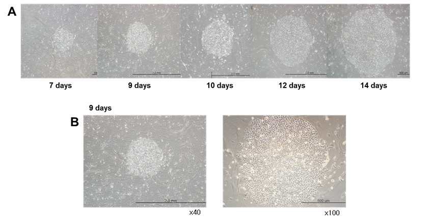 Fig. 15. (A) Mito-mEF에서 인간 배아줄기세포 배양. 인간 배아줄기세포의 증식 확인, (B) 9일 된 인간 배아줄기세포