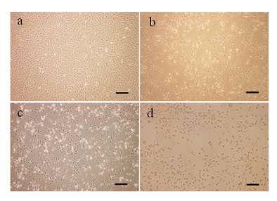 그림. 골수유래 줄기세포의 신경 세포 분화일령에 따른 세포 사진