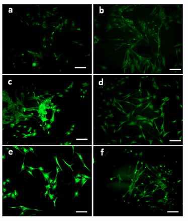 그림. 골수유래 줄기세포를 심근 세포로 분화 유도 후 신경세포 특이 마커 발현 분석