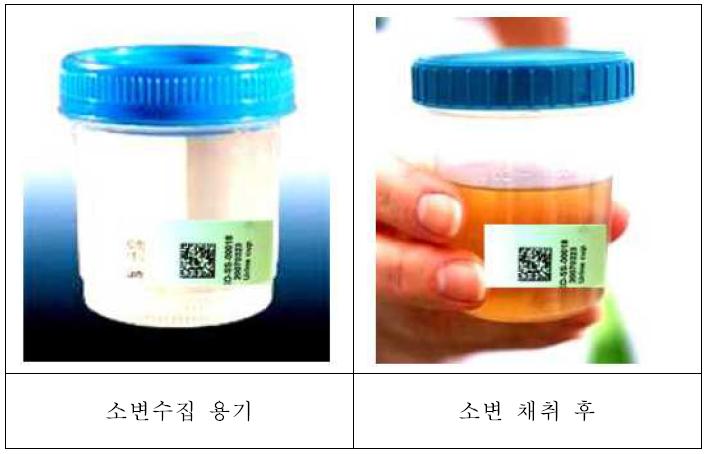 소변채취 예시