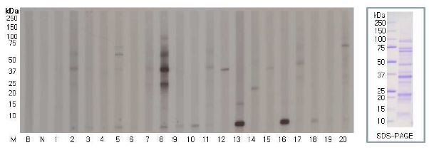 Fig. 12. 일반옥수수 단백질에 대한 환자혈청의 반응성 실험결과