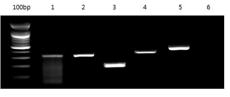 그림 1. 기 보고된 조건으로 one-step RT-PCR 결과.