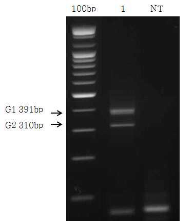그림 20. 노로바이러스 G1, G2 duplex PCR 결과