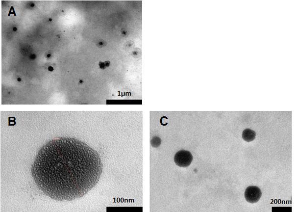 The TEM images of Lycopene nanostructured lipid carriers (A,B,C)