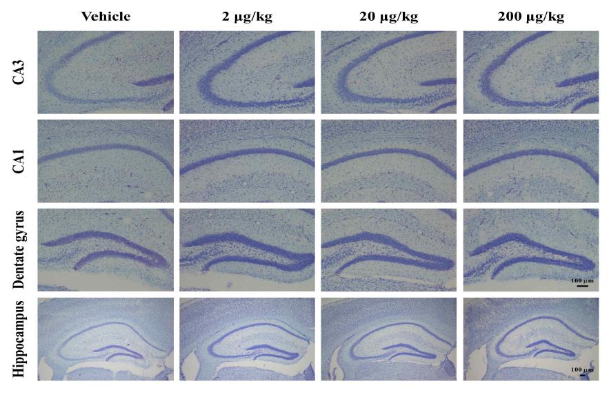 4주간의 신경독성물질 투여 후 Nissl staining한 결과.
