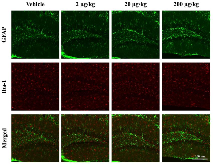 신경독성물질 투여에 따른 glial activation을 해마에서 확인.