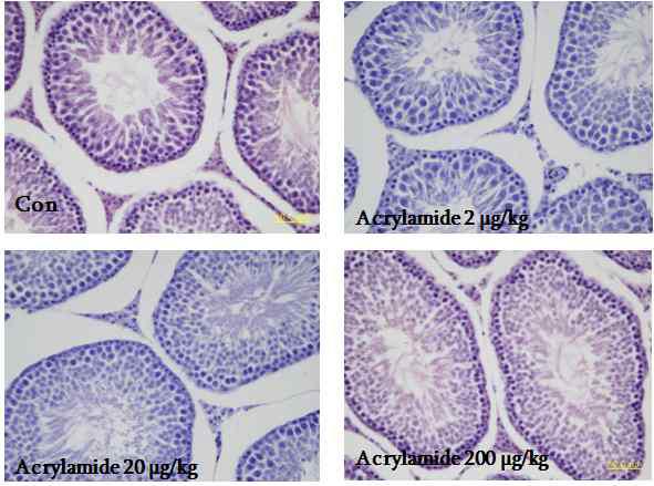 Sperm number and daily sperm production in BL6 mice after acrylamide exposure for 4 weeks.