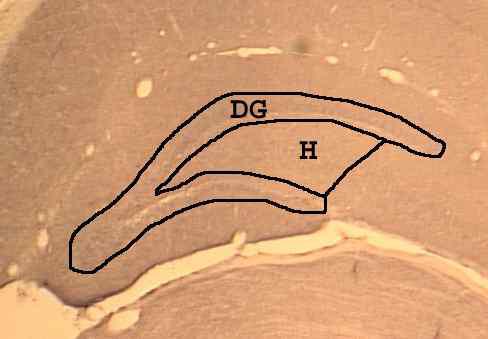 흰 쥐의 뇌 절편의 dentate gyrus (DG)와 Hilus (H)를 표시한 그림.