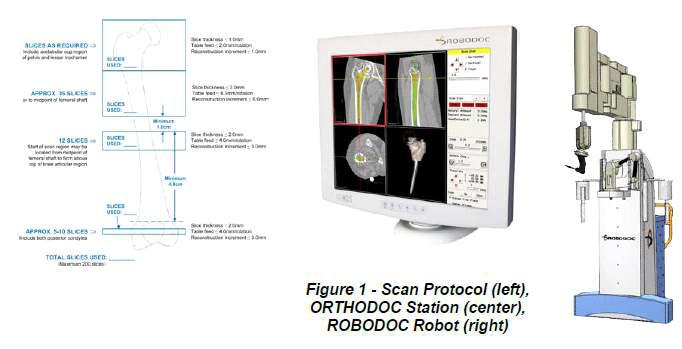 ROBODOC surgical assistant system