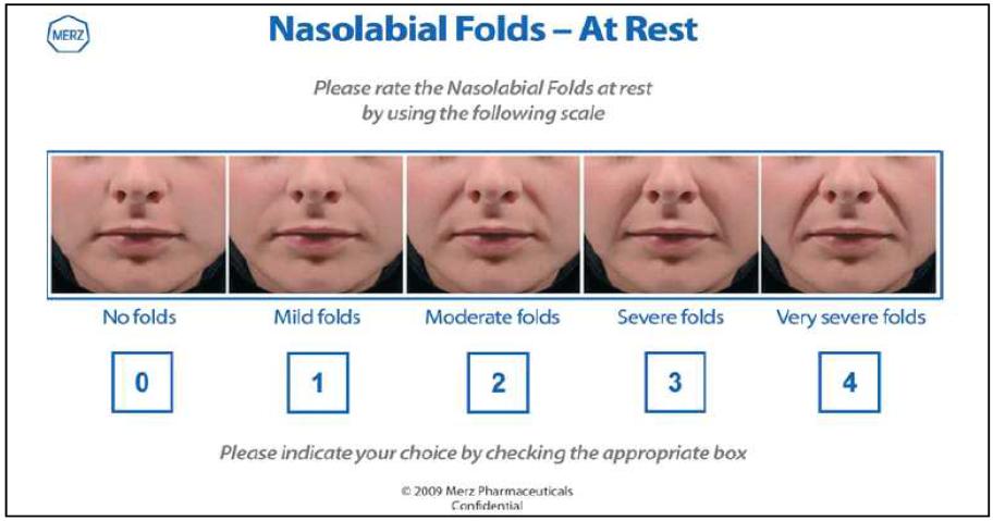 Merz Nasolabial fold severity scale.