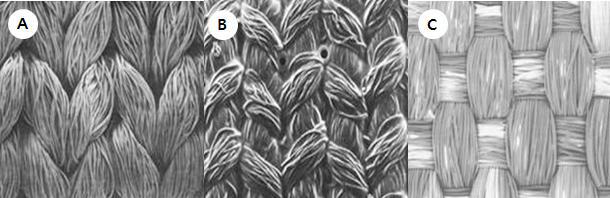 (A) DeBakey standard-knit Dacron 인공혈관 (x37) (B) Vascutek Gelsoft Koper로 매듭되고 gelatin으로 마감된 Dacron graft (x40) (C) 위, 아래로 짜여진 (woven) Dacron (x50)