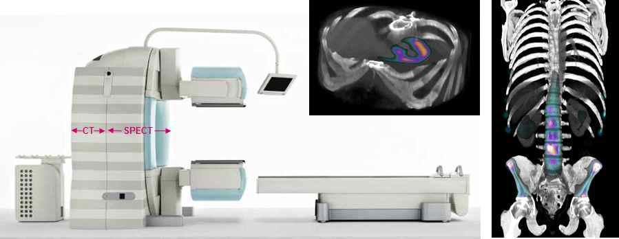 SPECT/CT