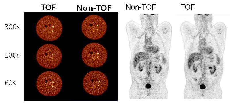 TOF 측정 기술을 이용한 PET 영상질의 향상