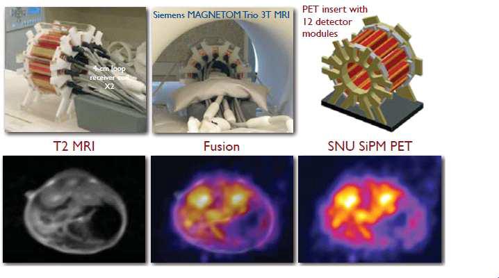 서울대학교에서 개발한 SiPM 기반 PET과 영상 (3T MRI 와 결합)