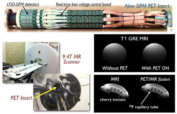 서울대학교에서 개발한 새로운 SiPM 기반 PET과 영상 (9.4T MRI 와 결합)