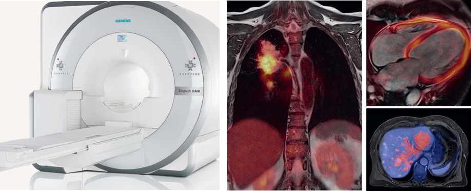APD를 이용한 일체형 PET/MRI