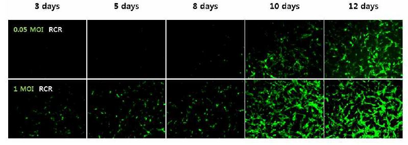 그림 2. CT-26에서 RCR-GFP의 시간대별, 농도별 감염효율 확인