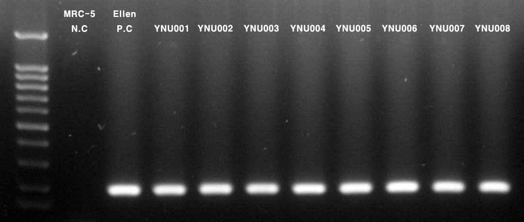 Viruses isolated from patients (YNU001~YNU008) were identified by PCR with VZV primer.