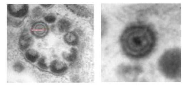 Electron microscopy of VZV YNU003 strain cultured in MRC-5 cell