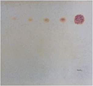 TLC chromatogram of Butorphanol Tartrate