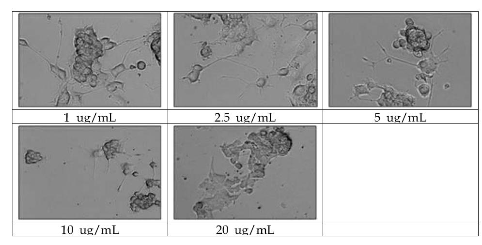 산화아연 (ZnO) 20 nm-negative을 농도별로 처리하여 신경돌기가 생성된 PC-12세포
