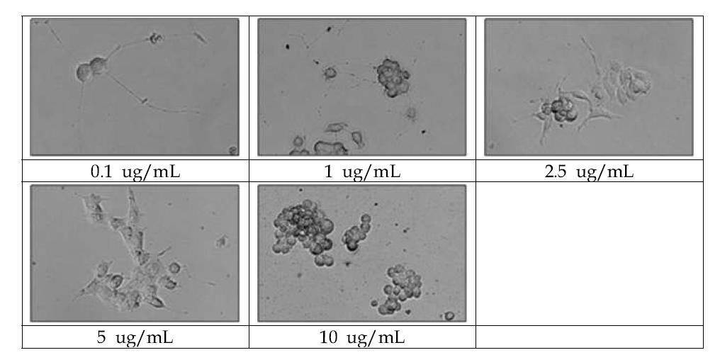 산화아연 (ZnO) 100 nm-negative을 농도별로 처리하여 신경돌기가 생성된 PC-12세포