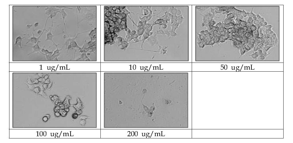 이산화규소(SiO2) 100 nm를 농도별로 처리하여 신경돌기가 생성된 PC-12세포