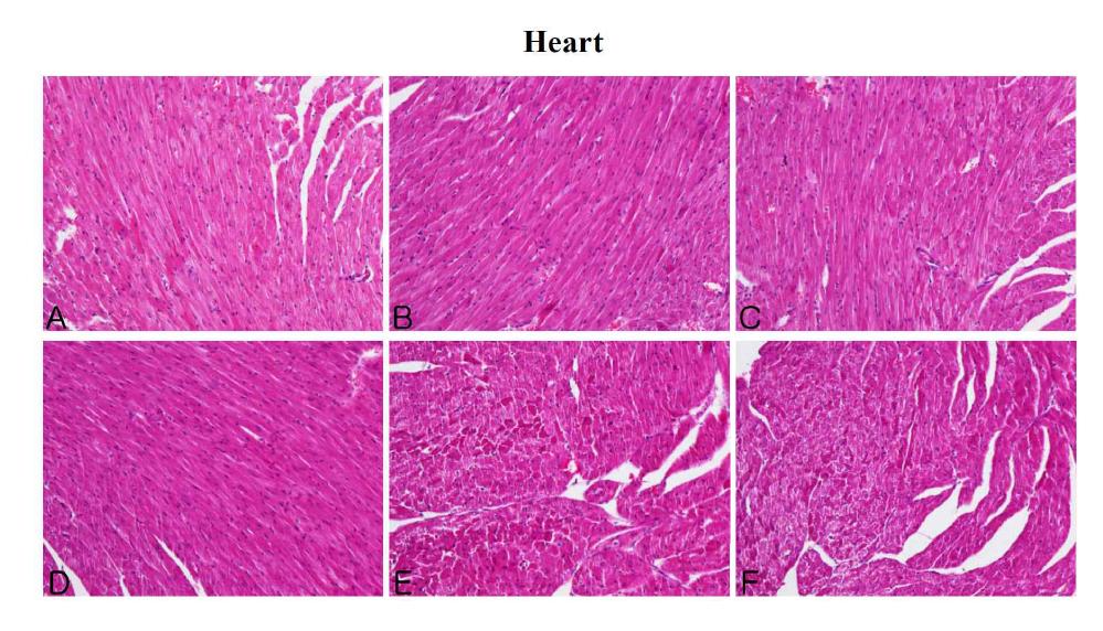 The microscopic changes of heart in male ICR mice for 14 days after repeated exposure. Mice were respectively administered by intravenous injection with liposome, CNT, Dox, Doxil (0.2, 1, 5 mg/kg) and Dox-CNT (0.2, 1, 5 mg/kg). The organ sections were stained with hematoxylin and eosin. A: Control, B: Liposome, C: CNT, D: Dox, E: Doxil 5 mg/kg, F: Dox-CNT 5 mg/kg