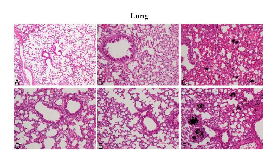 The microscopic changes of lung in male ICR mice for 14 days after repeated exposure. Mice were respectively administered by intravenous injection with liposome, CNT, Dox, Doxil (0.2, 1, 5 mg/kg) and Dox-CNT (0.2, 1, 5 mg/kg). The organ sections were stained with hematoxylin and eosin. A: Control, B: Liposome, C: CNT, D: Dox, E: Doxil 5 mg/kg, F: Dox-CNT 5 mg/kg