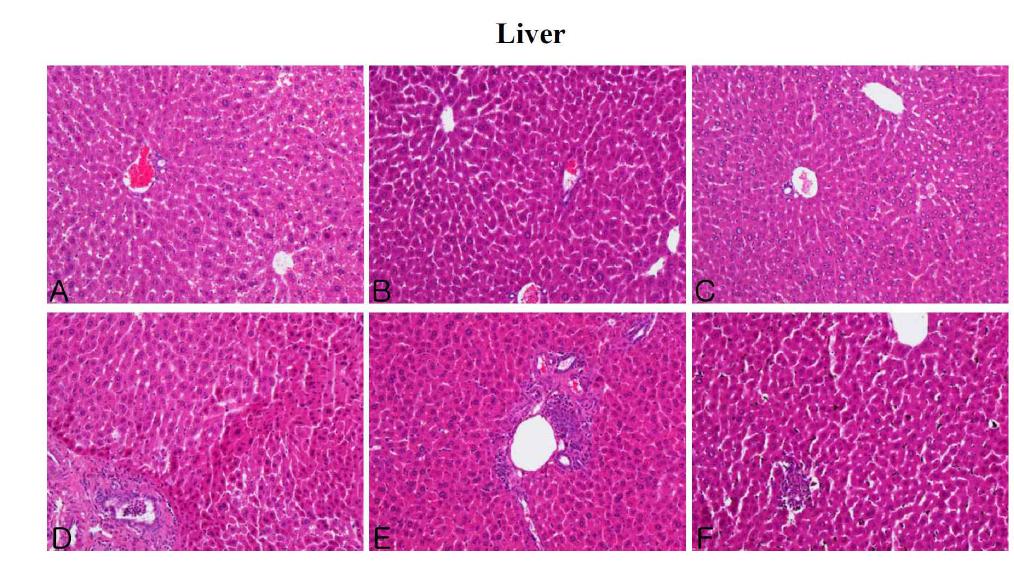 The microscopic changes of liver in male ICR mice for 14 days after repeated exposure. Mice were respectively administered by intravenous injection with liposome, CNT, Dox, Doxil (0.2, 1, 5 mg/kg) and Dox-CNT (0.2, 1, 5 mg/kg). The organ sections were stained with hematoxylin and eosin. A: Control, B: Liposome, C: CNT, D: Dox, E: Doxil 5 mg/kg, F: Dox-CNT 5 mg/kg