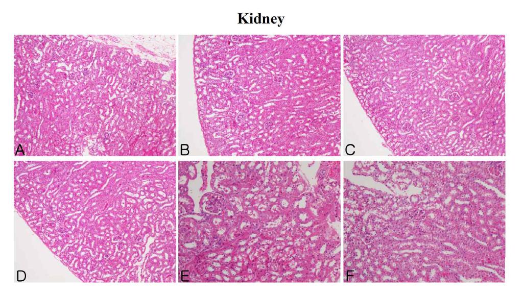 The microscopic changes of kidney in male ICR mice for 14 days after repeated exposure. Mice were respectively administered by intravenous injection with liposome, CNT, Dox, Doxil (0.2, 1, 5 mg/kg) and Dox-CNT (0.2, 1, 5 mg/kg). The organ sections were stained with hematoxylin and eosin. A: Control, B: Liposome, C: CNT, D: Dox, E: Doxil 5 mg/kg, F: Dox-CNT 5 mg/kg