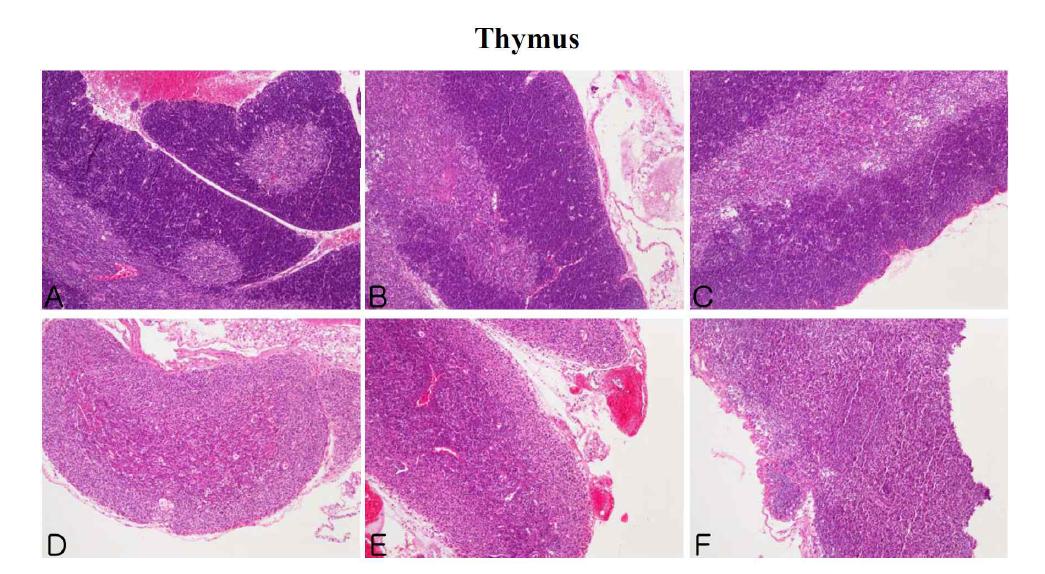 The microscopic changes of thymus in male ICR mice for 14 days after repeated exposure. Mice were respectively administered by intravenous injection with liposome, CNT, Dox, Doxil (0.2, 1, 5 mg/kg) and Dox-CNT (0.2, 1, 5 mg/kg). The organ sections were stained with hematoxylin and eosin. A: Control, B: Liposome, C: CNT, D: Dox, E: Doxil 5 mg/kg, F: Dox-CNT 5 mg/kg