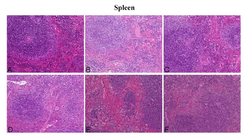 The microscopic changes of spleen in male ICR mice for 14 days after repeated exposure. Mice were respectively administered by intravenous injection with liposome, CNT, Dox, Doxil (0.2, 1, 5 mg/kg) and Dox-CNT (0.2, 1, 5 mg/kg). The organ sections were stained with hematoxylin and eosin. A: Control, B: Liposome, C: CNT, D: Dox, E: Doxil 5 mg/kg, F: Dox-CNT 5 mg/kg