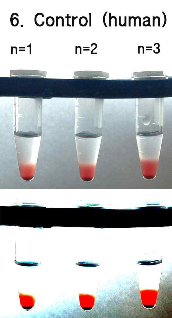 Control of human erythrocyte agglutination and sedimentation. Erythrocyte were treated with PBS for 2hrs.