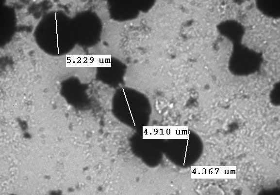 Effects of CNT on mouse erythrocyte morphology observed under the TEM (transmission electron microscopy). Erythrocyte were treated with CNT (55 ug/ml) for 1hrs.