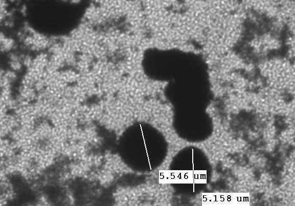 Effects of Doxil on mouse erythrocyte morphology observed under the TEM (transmission electron microscopy). Erythrocyte were treated with Doxil (55 ug/ml) for 1hrs.