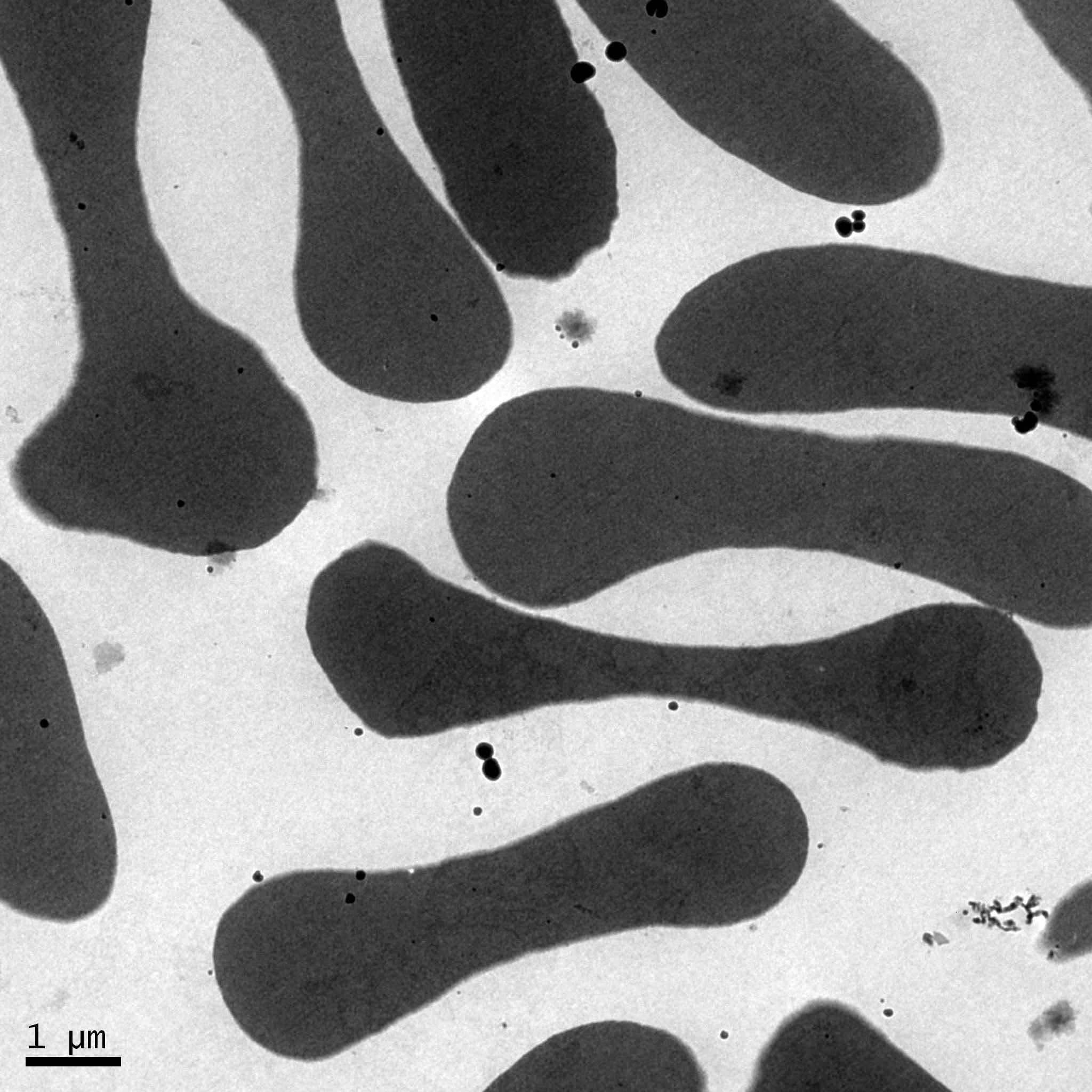 Effects of CNT on human erythrocyte morphology observed under the EM (electron microscopy). Erythrocyte were treated with CNT (55 ug/ml) for 1hrs