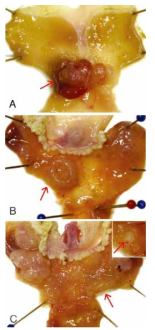 MNU induced gastric cancer model