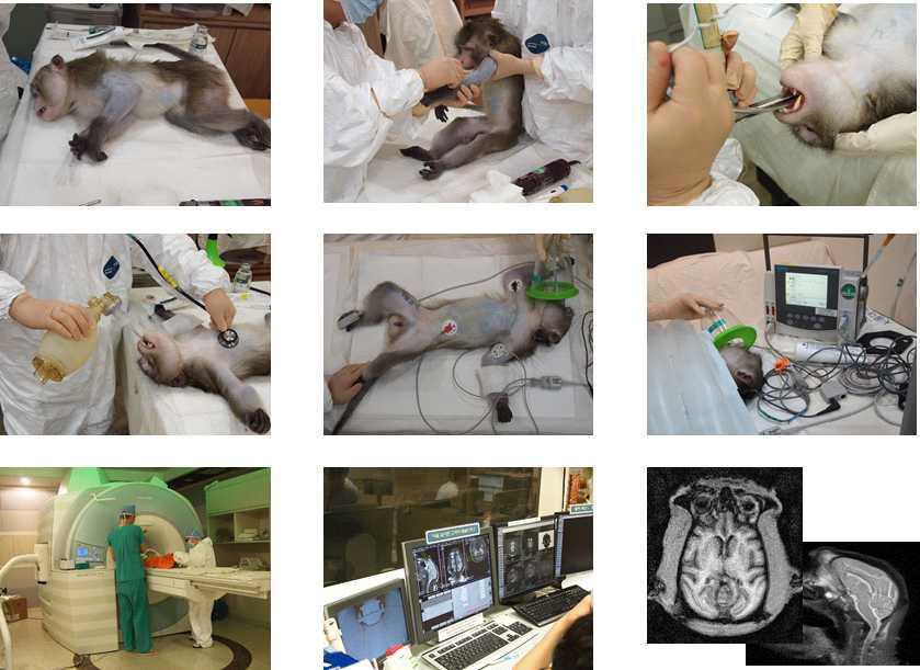 PD/AD 영장류 모델 영상진단학적 평가를 위한 MR 촬영 과정