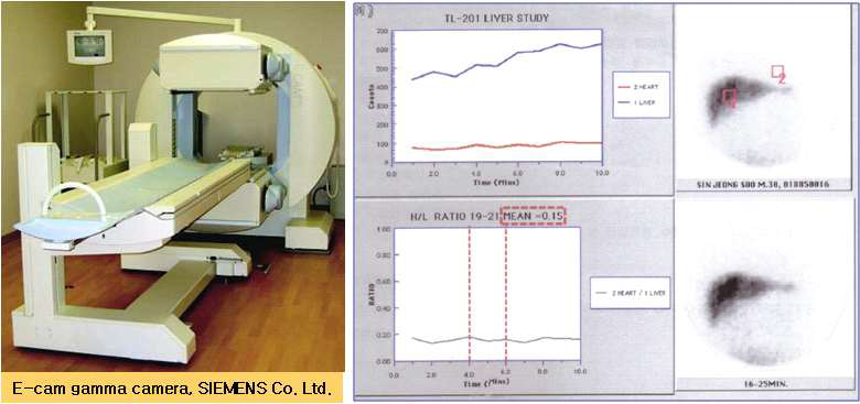 그림 12. TI-201 Per rectal scintigraphy 검사기기와 정상인의 영상결과