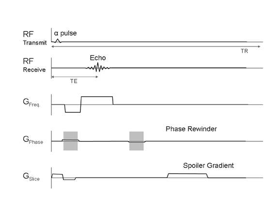 Spoiled gradient echo pulse sequence