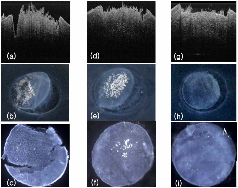 2D-OCT images of the cornea surface properties of porcine eye after flapping (a), a photography of flapped eyeball (b), and flapped cornea (c) with a fluence of 2J/cm2, a scanning speed of 1 mm/sec and eye pressure of 10 mmHg
