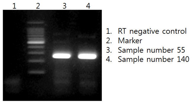 Results of nested-PCR with NKⅡ-R2 primer