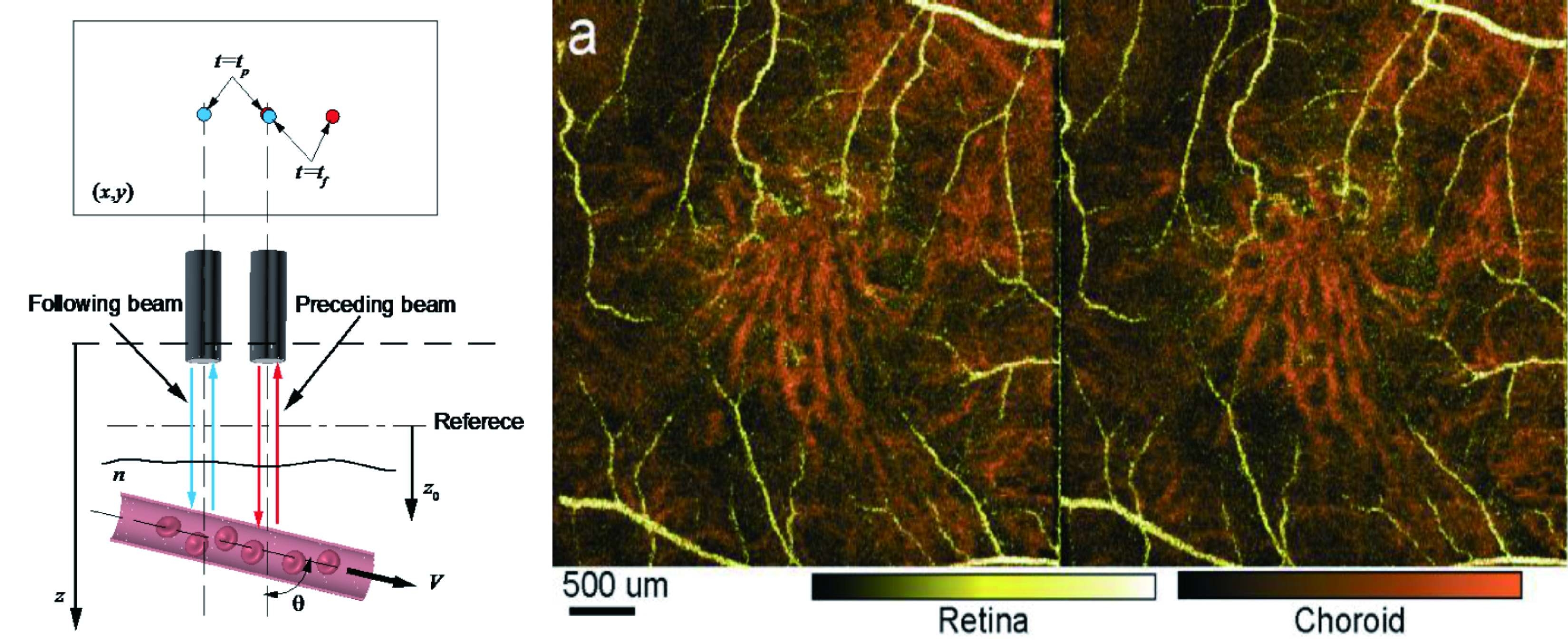 Dual beam scan Doppler flow detection scheme(left) and Retinal and choroidal vasculature of human eye(right)