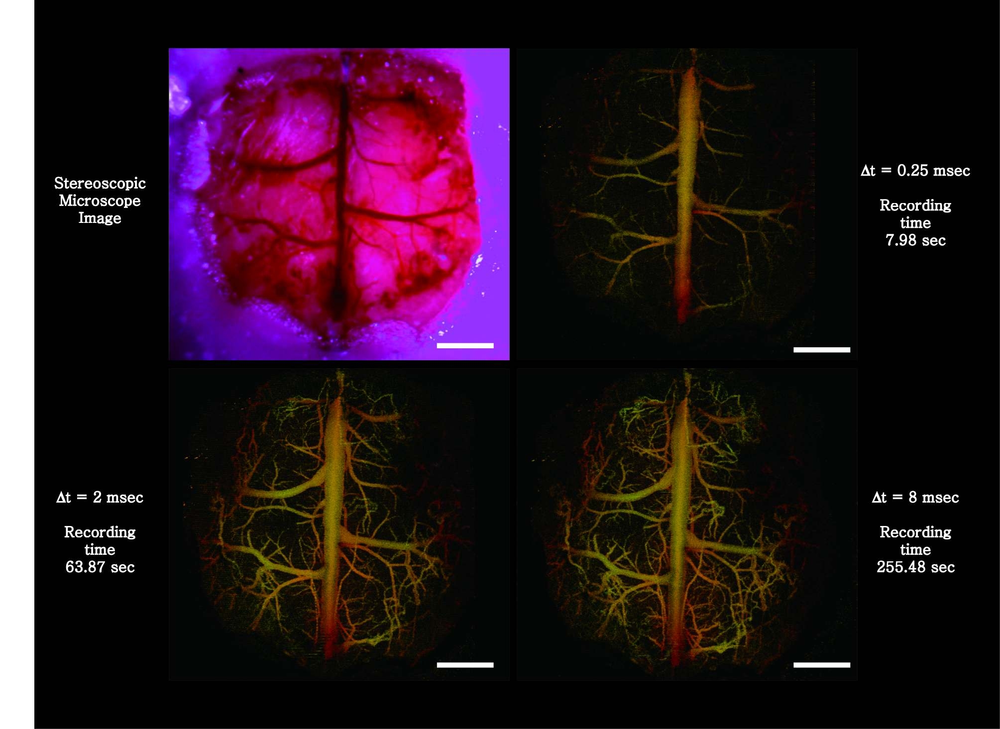 Mouse brain, 6mm(X) ?5.7mm(Y) ?4mm(Z) in 4.41 s color coded by depth,